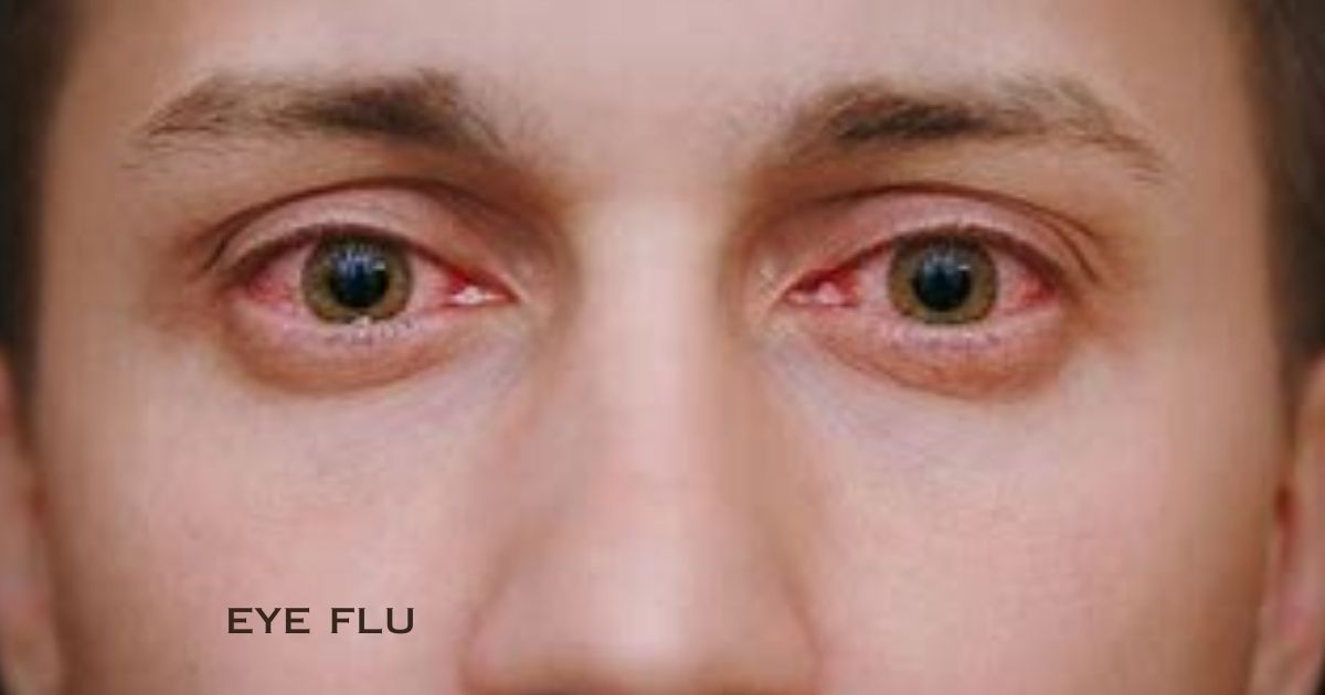 सावधान! वेगाने पसरतोय पावसाळ्यात Eye Flu; ‘ही’ आहेत लक्षणं आणि उपाय.